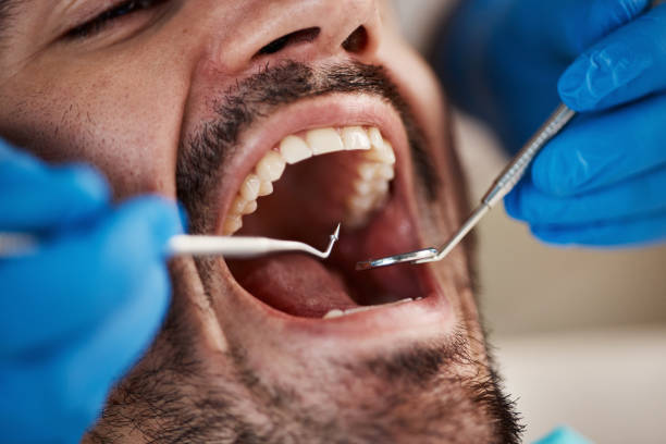 Best Emergency Dental Care for Broken or Chipped Teeth in Blackville, SC