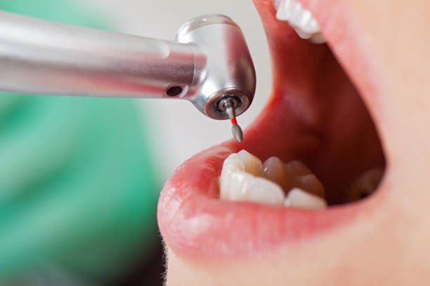 Best Emergency Dental Care for Broken or Chipped Teeth in Blackville, SC